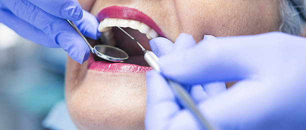 Best Emergency Root Canal Treatment in West Terre Haute, IN